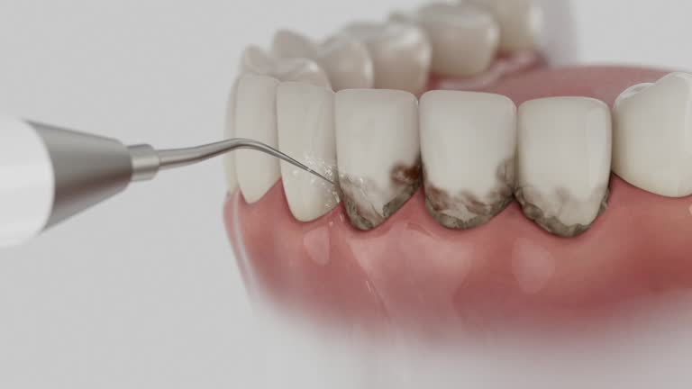 Reliable Dental contractor in Clarksville, AR by Smile Center Dentistry